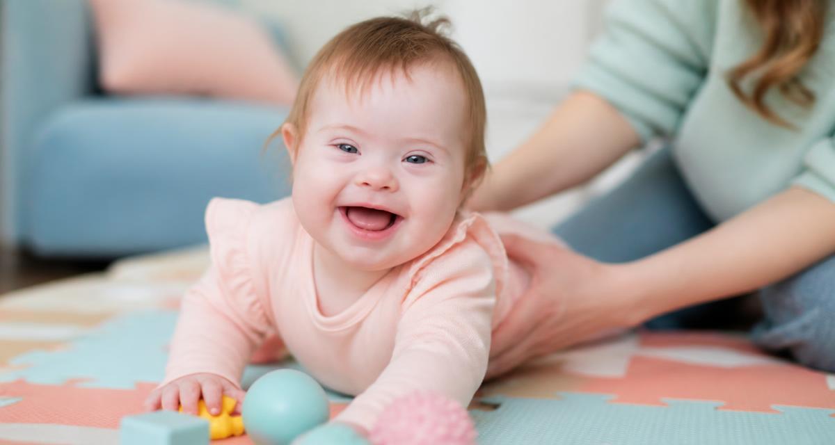Babies with Down Syndrome — baby care guide for new parents